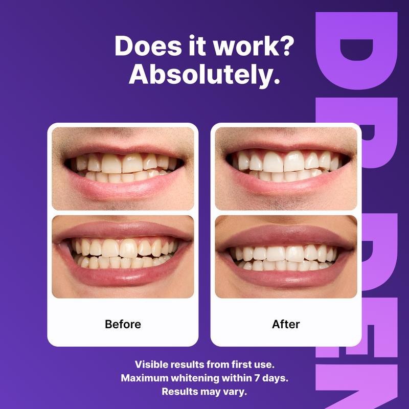 Dental Whitening Strips